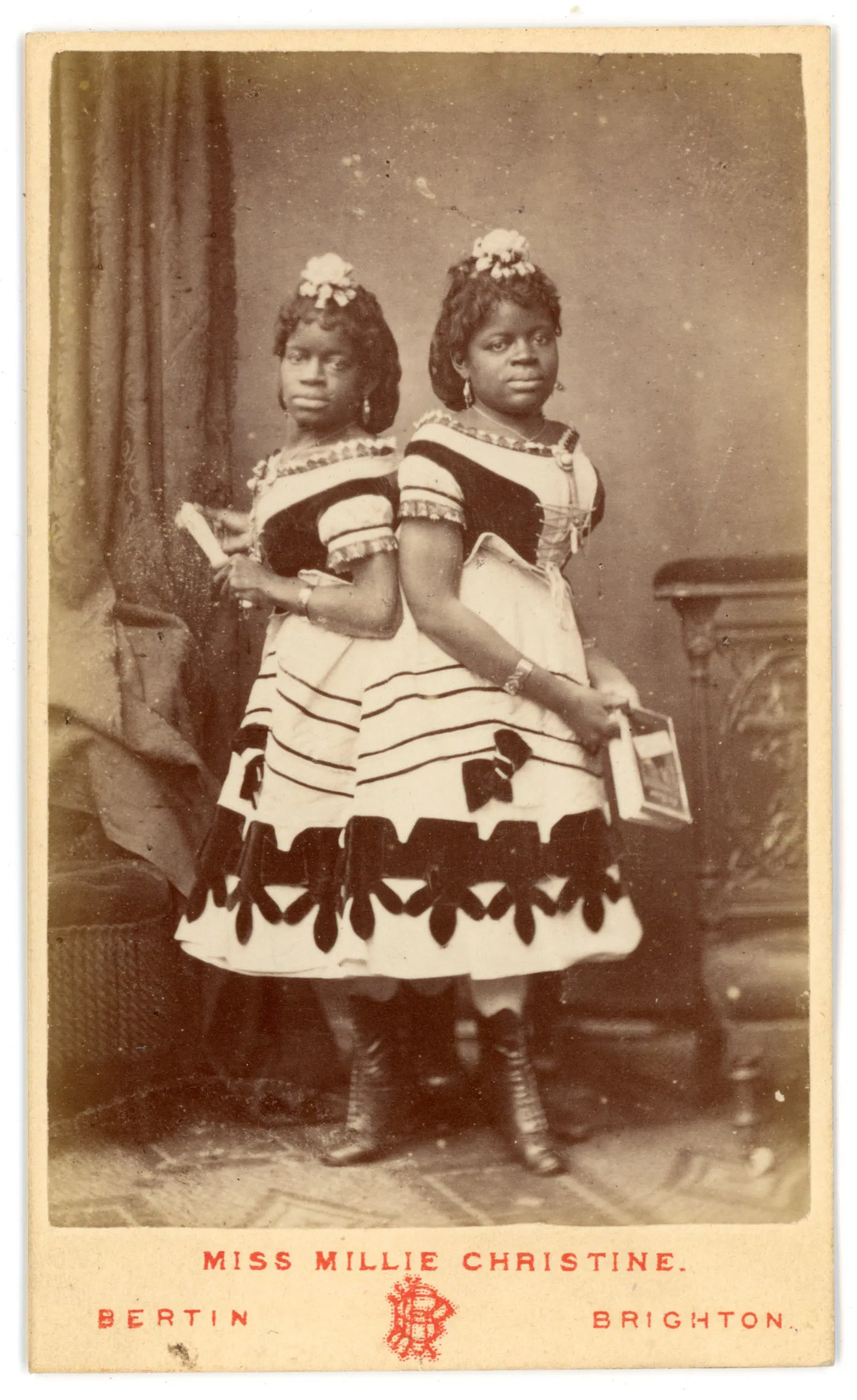 CDV Millie Christine Siamese Twin Performers Brighton