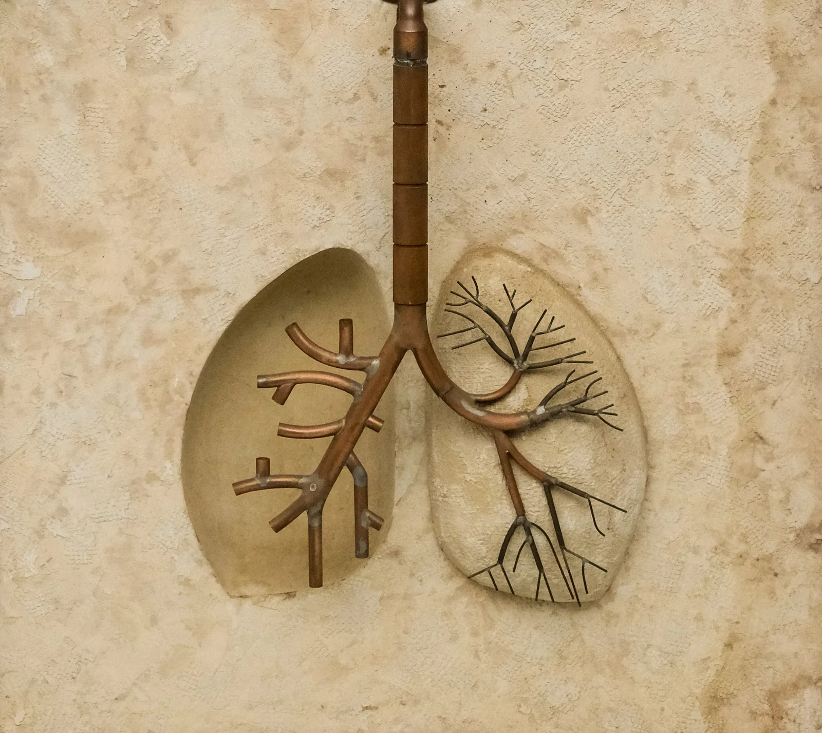 Norman Hacking, Lung Sculpture